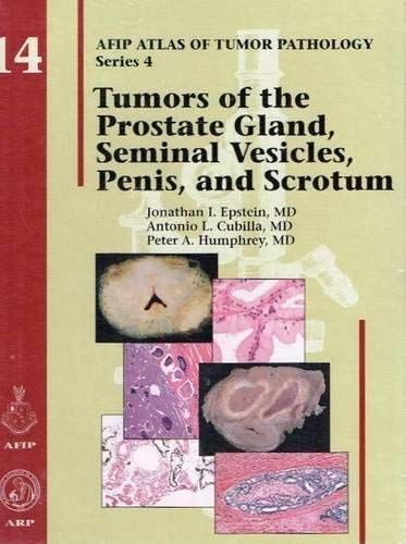 Tumors of the Prostate Gland，Seminal Vesicles，Penis，and Scrotum (AFIP Atlas of Tumor Pathology: Series 4) Epstein，Jonathan I. Amazon.fr - Tumors of the Prostate Gland, Seminal Vesicles